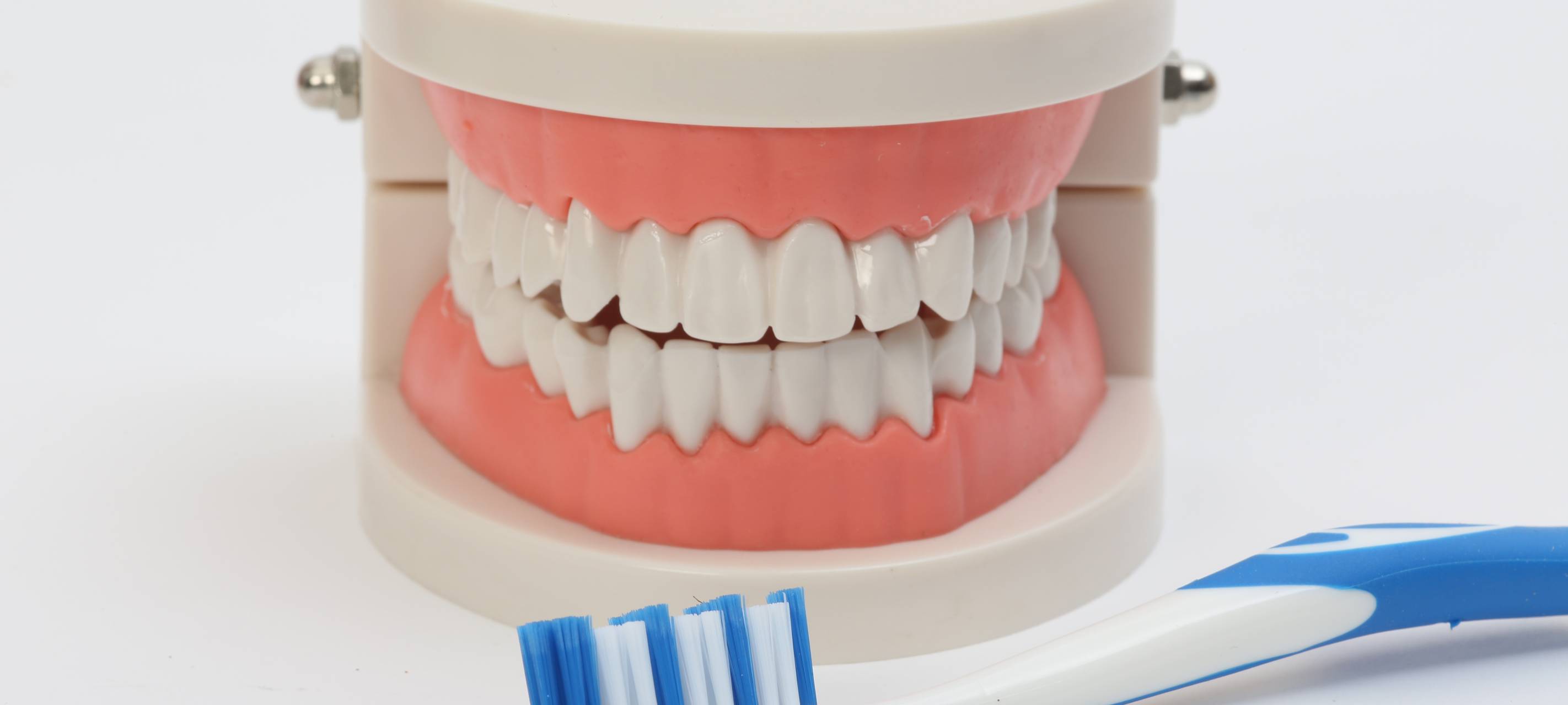 Kreidezähne häufen sich