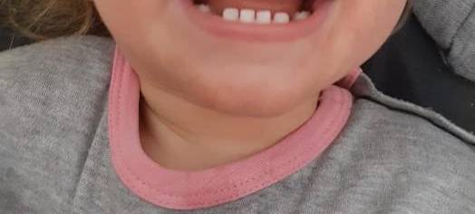 Familien-Challenge: Lächeln