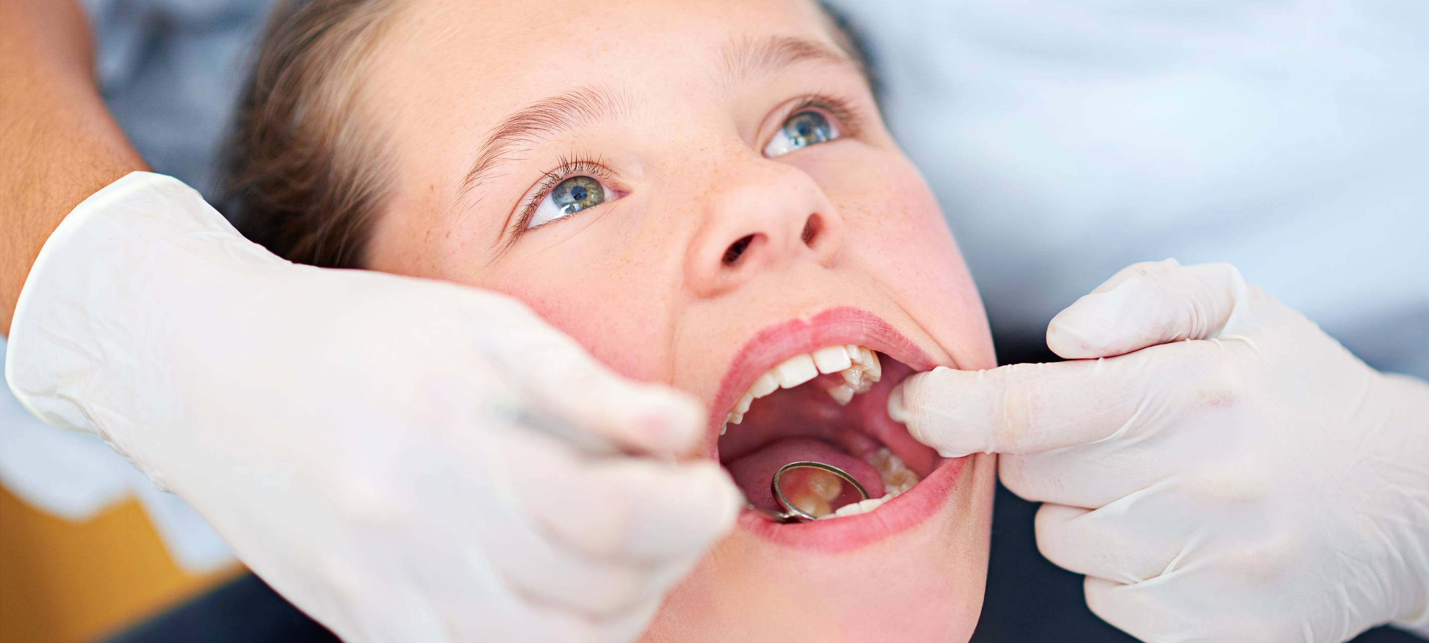 Hamm: Jeder dritte Erstklässler hat Zahnfüllungen